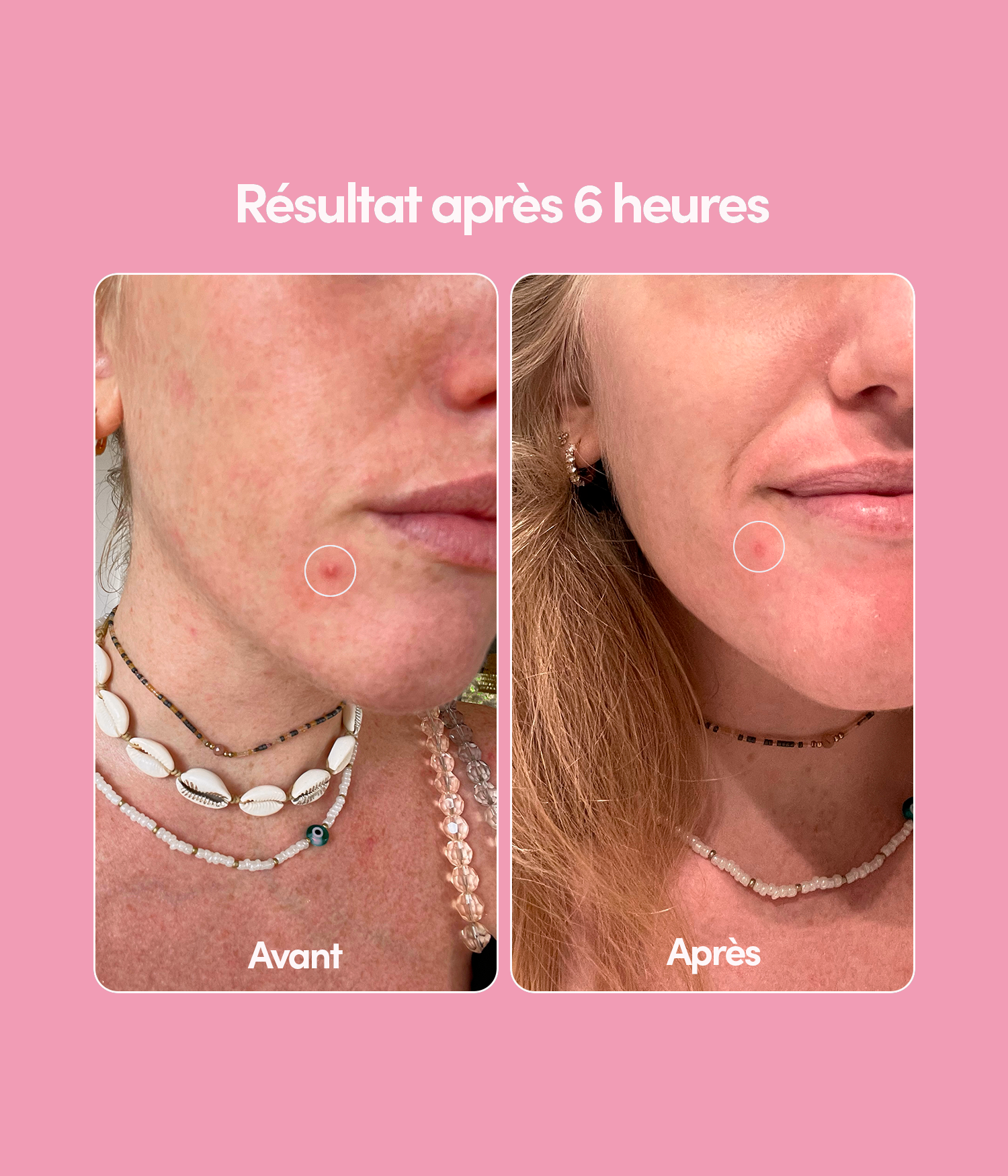 24 Patchs Boutons Unicorn Edition